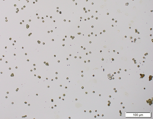Liverwort spores (dry) are less than 3.5 microns in diameter
