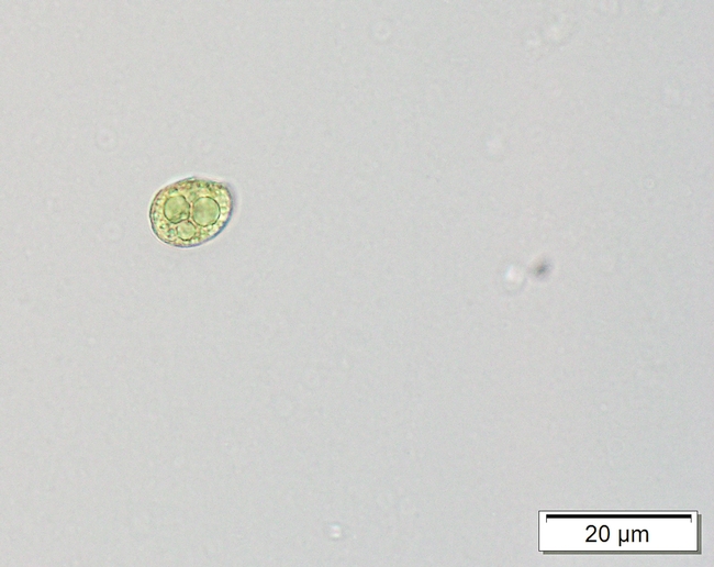 Liverwort spores close up
