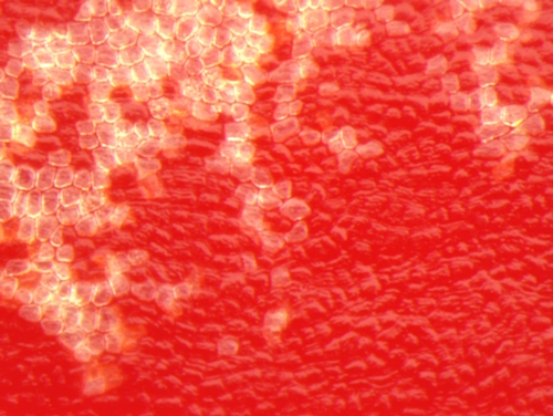 5. Close up of healthy and affected tissue