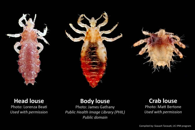 Figure 1. Species of lice found on humans.