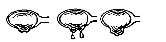 Illustration depicting three spoons at different stages of the sheet test.