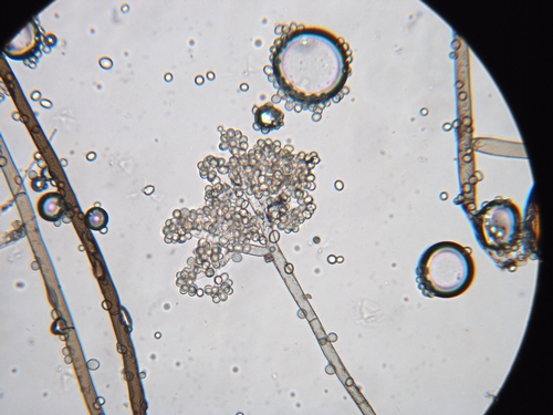 Clustered spores of Botrytis cinerea.  Photo courtesy Steven Koike, UCCE.