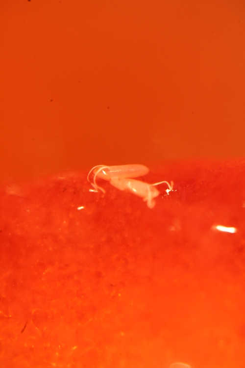 Photo 1: Vinegar fly eggs under the microscope.  Long fibers are respiratory tubes.
