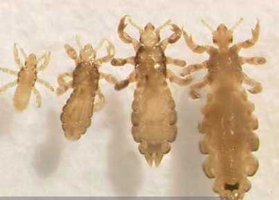 Head lice life stages. (Photo: Dr. Shujuan [Lucy] Li)