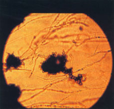 Photomicrograph of the survival propagule (microsclerotium) of Verticillium dahliae.