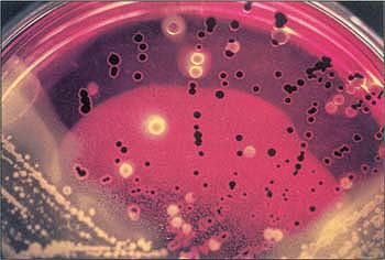 Numerous black colonies growing on XLT4 agar plate (special selective media) suggest Salmonella organisms. The suspect black colonies undergo further testing and are confirmed to be Salmonella.
