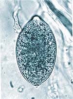 Phytophtora ramorum, the pathogen that causes sudden oak death.