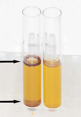 Comparison of the visual appearance of tubes containing test fluid of feed sample no. 5, spiked to attain 5% bovine dried blood (BDB) (left) and an unspiked sample (right). The presence of BDB in fluid to be tested by the Reveal assay is readily identifiable on the left. Blood cells are floating at the interphase (arrow) and suspended in the fluid and sediment (arrow). Since the antibody incorporated in the Reveal test strips does not cross-react with blood cells, the same sample (5% BDB) tested negative. Samples of all five feeds spiked to attain only 1% BDB tested positive with the realtime PCR technology, which detects the bovine mitochondrial DNA in nucleated white blood cells.
