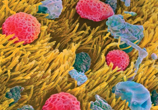 The surface of a person's windpipe (photographed with a colored electron-scanning microscope) can trap pollen grains (pink) on hairlike cilia (yellow). In asthmatic or allergic persons, the particles can cause a hypersensitive reaction that leads to breathing difficulties.
