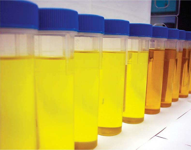 Freshly extracted canola (left) and mustard oils (right) from Brassicaceous plants can be grown for the phytomanagement of soluble selenium in the soil.