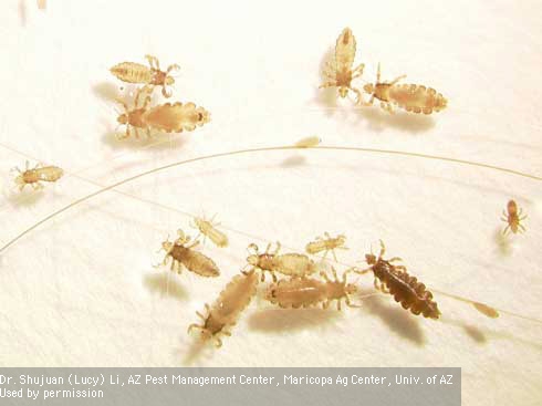Head lice adults, nymphs, and eggs (nits). [Credit: Dr. Shujuan (Lucy) Li]