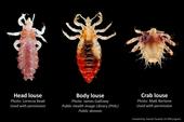 Side by side images of a head louse, body louse, and crab louse.
