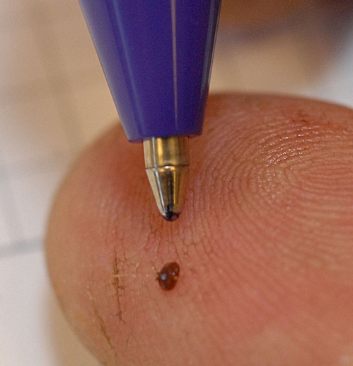 TINY MITE--The tip of the pen shows just how tiny the varroa mite is. (Photo by Kathy Keatley Garvey)