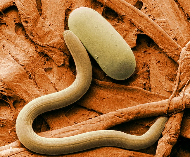Soybean cyst nematode and egg. (Photo courtesy of the U.S. Department of Agriculture's Agricultural Research Services.)