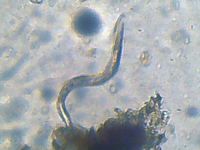 This is the root-knot nematode, Meloidogyne chitwoodi, that Cynthia Gleason of Washington State University studies. (Image courtesy of Wikipedia)
