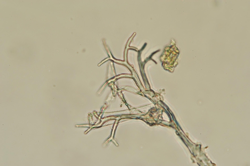 Foto microscopica del patogeno de honguillo.