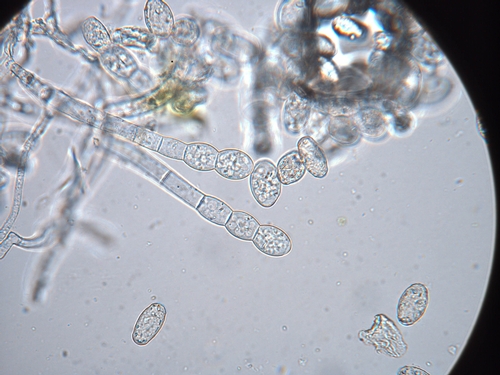Foto 1: El patógeno del mildú polvoriento bajo del microscopio.  Foto por Steven Koike.