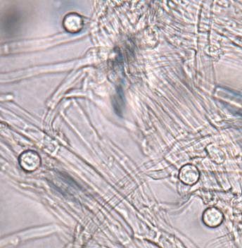 Foto 4.  Estructuras microscópicas llamadas clamidosporas posibilitan el patógeno de Fusarium de sobrevivir en el suelo. Foto por Steven Koike, UCCE