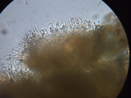 Foto 3. Foto muy de cerca de una porción de un cuerpo fructífero del patógeno Zythia, cada espiga erigida produce un esporo infectivo. Foto por Steven Koike, UCCE.