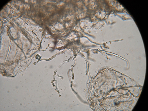 Micelio de Phytophthora. Note la carencia de paredes celulares adentro de la hifa.