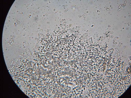 Photo 4. Zythia produces tiny spores that are spread by splashing water.    Photo: Steven Koike, UCCE.