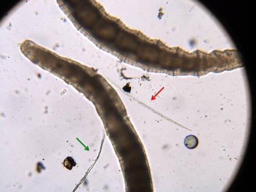 Figure 5. Oligochaetes are much larger than the parasitic nematodes (shown here is an Aphelenchoides species of nematode, red arrow) that attack plants. Object in bottom left is a single fiber from a paper towel (green arrow).  Photo by Steven Koike, UCCE.