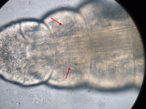 Figure 3. For oligochaete worms, each body segment bears characteristic spines or chaeta.  Photo by Steven Koike, UCCE.