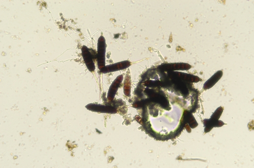 Photo courtesy Steven Koike, UCCE.  Teliospores of Phragmidium rubi-idaei.