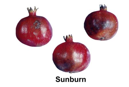 Sunburn