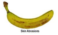 banana_skin_abrasions