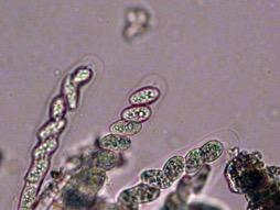 Fig. 1.  Ascospores of Botryosphaeria causing Ficus canker disease. Photo: A J Downer.