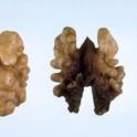 Potassium Deficiency in Walnut. photo by Kyoto Uriu. UC Statewide IPM Project, © UC Regents