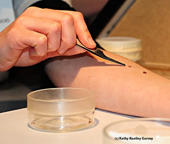 Two bed bugs on Danielle Wishon's arm. (Photo by Kathy Keatley Garvey)