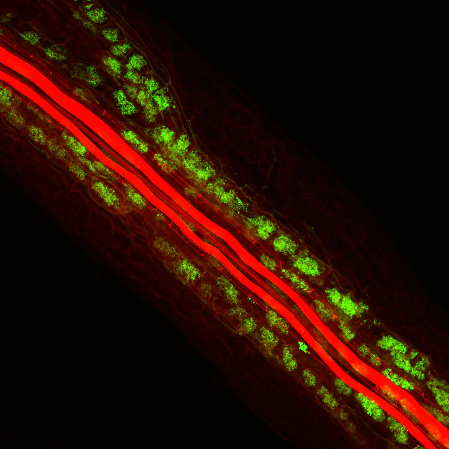 Arbuscular mycorrhizal fungi (green) within a Medicago truncatula (model legume) root (red). (Image courtesy of the Salk Institute