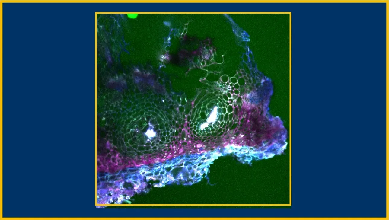 Imagen microscópica de una cáscara externa de pistacho. 