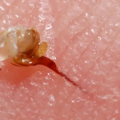 Here's a close-up of what the stinging apparatus looks like in the skin. (Photo by Kathy Keatley Garvey)