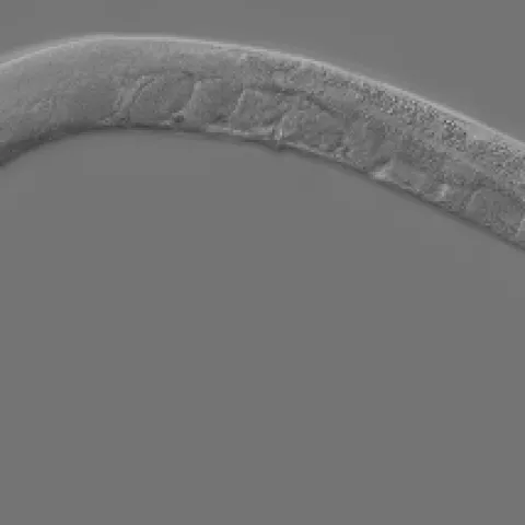 Adult Caenorhabditis elegans. Wikipedia describes it as "a free-living, transparent nematode, about 1mm in length, that lives in temperature soil environments." (Courtesy of Wikipedia)