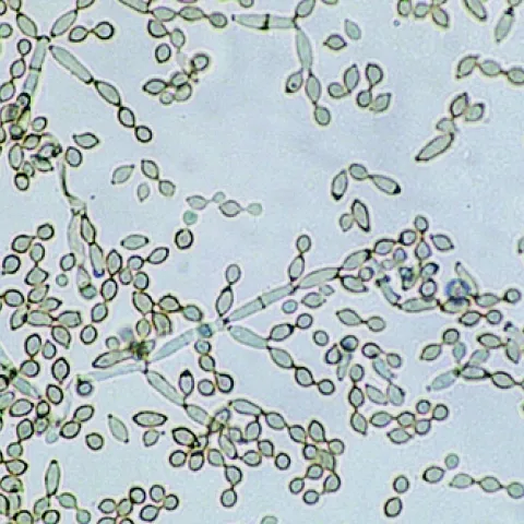 Not my picture, but very much what I saw with our light microscope. Irregular shaped spores, some lemon shapes mixed in and walled and branched mycelium with some color to it.