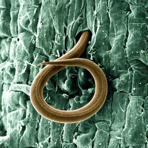 A juvenile root-knot nematode (Meloidogyne incognita) penetrates a tomato root on Jan. 24, 2013. Once inside, the juvenile, which also attacks cotton roots, causes a gall to form and robs the plant of nutrients. Photo by William Wergin and Richard Sayre. Colorized by Stephen Ausmus. (USDA Photo, Courtesy of Wikipedia)