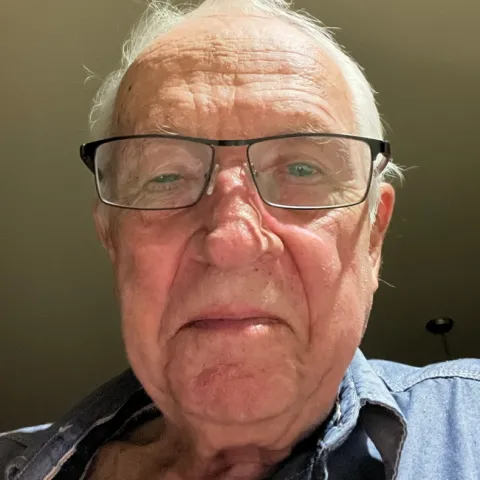 Dan Hemesath's right eye is swollen after being exposed to sap in silver spurge.