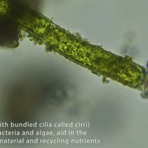 Single celled ciliate
