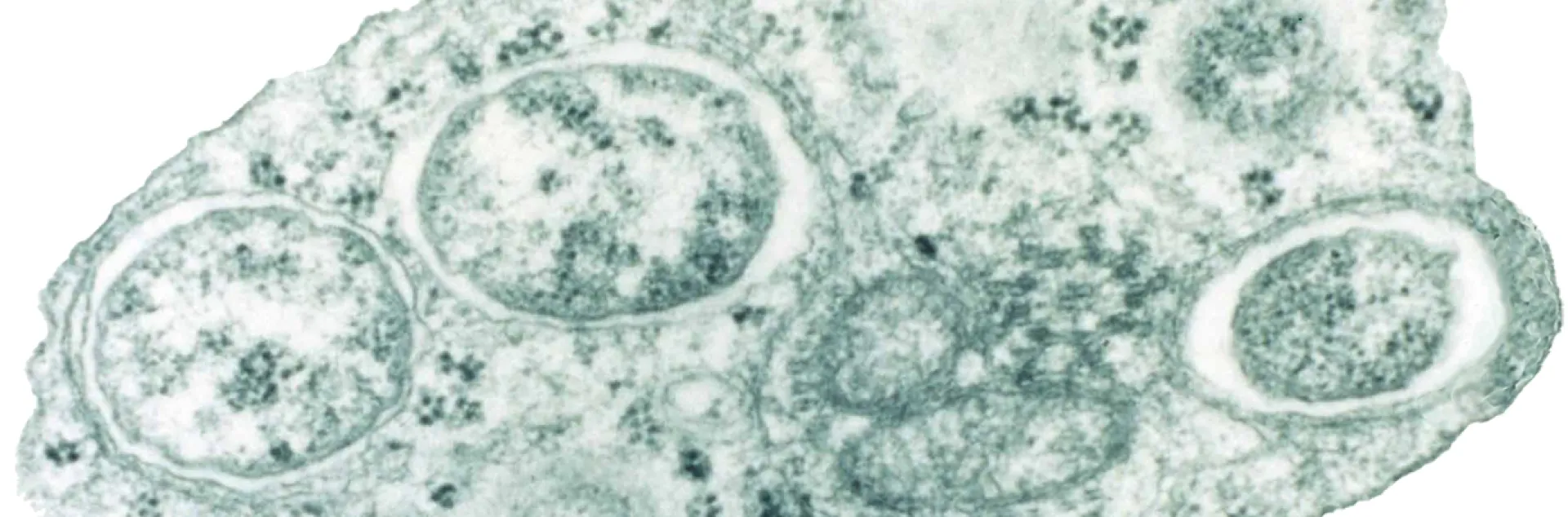 ransmission electron micrograph of Wolbachia within an insect cell. (Wikipedia)