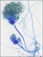 Aspergillus, a common fungus that rarely causes problems but can affect immuno-compromised people