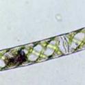 Micrograph of filamentous algae (Spirogyra spp.) *file325885* Photo credit: Dr. Morgan Vis, Ohio University. Used with permission.